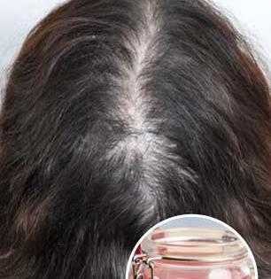 केस धुण्यापूर्वी २ तास आधी केसांना लावा 'जादुई पाणी'! टक्कल पडलेल्या डोक्यावरही येतील केस - करा असरदार उपाय...