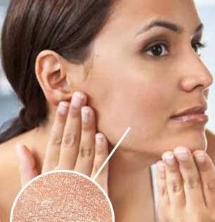 थंडीमुळे त्वचा कोरडी पडून चेहरा भुरकट दिसतो? चेहऱ्यावर शिंपडा 'हे' पाणी, त्वचा हायड्रेटेड राहील