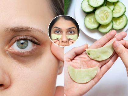Cucumber eye mask: Fade dark circles, refresh eyes naturally.