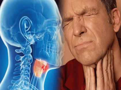 Know the symptoms and causes throat cancer, | गळ्याच्या कॅन्सरचे शिकार होण्याआधीच व्हा सावध, जाणून घ्या लक्षणं आणि कारणं