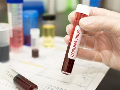 Coronavirus IGIB scientists develop low cost COVID 19 test | CoronaVirus: अल्पदरातील कोरोना चाचणीचा शोध; आयजीआयबीच्या शास्त्रज्ञांना यश