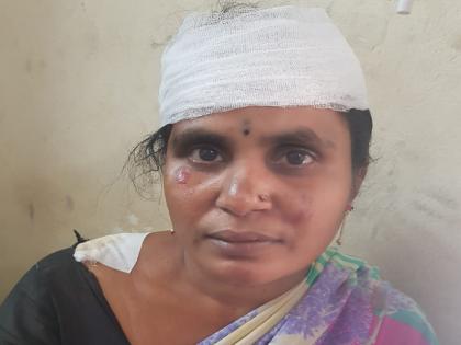 Lift of the lift, woman lamps, injuries woman injured | लिफ्टच्या बहाण्याने महिलेची चेन लंपास, झटापटीत महिला जखमी