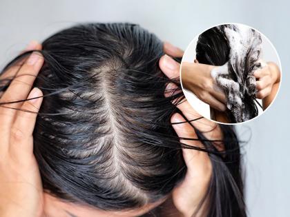 तेल लावलं नाही तरी केस चिप्प तेलकट दिसतात, चेहराही ऑइली होतो? करा १० सोप्या गोष्टी