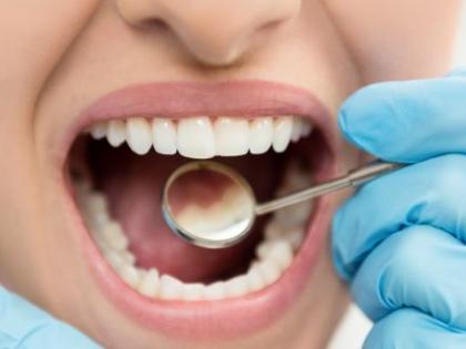 90% of Mumbai Indians complain of oral health; Urgent treatment needs to be done | ९० टक्के मुंबईकरांना मौखिक आरोग्याच्या तक्रारी; तातडीने उपचार करणे गरजेचे