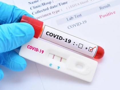 Corona virus: 1104 new corona infections in Pimpri on Wednesday; ! 1 thousand 071 people released from coronation | Corona virus : पिंपरीत बुधवारी ११०४ नवीन कोरोनाबाधित; १०७१ जण कोरोनामुुुक्त