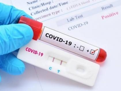 Corona virus : 350 corona patients recovered in Pune on Saturday; An increase of 373 | Corona virus : पुणे शहरात शनिवारी ३५० कोरोना रुग्ण झाले बरे; ३७३ ची नवीन वाढ   