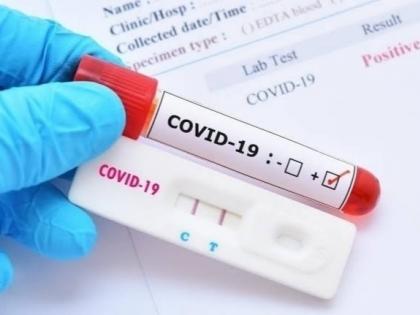 Corona virus news: 347 new corona cases increase in Pune on Wednesday | Corona virus news : पुणे शहरात बुधवारी ३४७ नव्या कोरोनाबाधितांची वाढ 