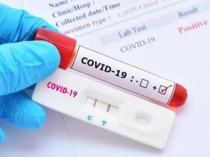 Corona virus: 247 new corona patients on friday in pune city | Corona virus : पुणे शहरात शुक्रवारी २४७ कोरोनाबाधितांची वाढ; २२८ रुग्ण झाले बरे