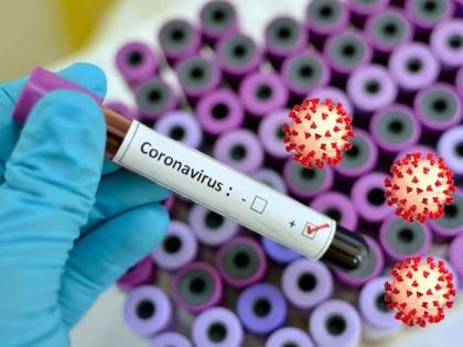 Corona Virus News: 135 new corona patients in pune and 120 pimpri on monday | Corona Virus News : पुणे शहरात सोमवारी १३५ तर पिंपरीत १२० कोरोनाबाधितांची वाढ 