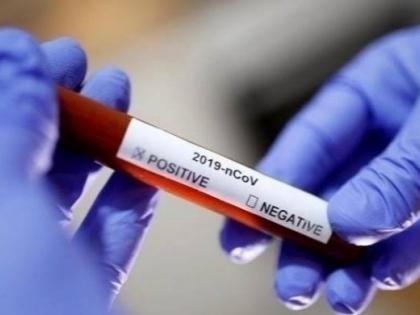 Corona virus News: Pune residents relieved after a week; 4077 on Monday and 2125 new corona in Pimpri | Corona virus News : पुणेकरांना तब्बल आठवड्याभरानंतर दिलासा; सोमवारी ४०७७ तर पिंपरीत २१२५ नवे कोरोनाबाधित Corona virus News: Pune residents relieved after a week; 4077 on Monday and 2125 new corona in Pimpri | Corona virus News : पुणेकरांना तब्बल आठवड्याभरानंतर दिलासा; सोमवारी ४०७७ तर पिंपरीत २१२५ नवे कोरोनाबाधित