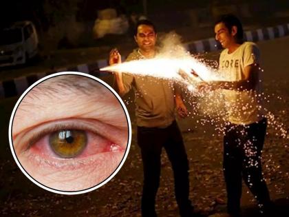 How to take care of your eyes while exploding firecrackers on Diwali? Read expert advice ... | दिवाळीत फटाके फोडताना डोळ्यांची काळजी कशी घ्यावी? वाचा तज्ज्ञांचा सल्ला...