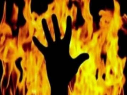 The lover poured petrol on his body and set himself on fire; 61% burnt to death in hospital | प्रियकराने अंगावर पेट्रोल ओतून स्वतःला पेटविले; ६१टक्के भाजल्याने रुग्णालयात मृत्यू