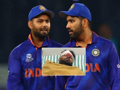 Indian team captain Rohit Sharma has inquired about Rishabh Pant injury over the phone  | Rishabh Pant Health Updates: कर्णधार रोहित शर्माची डॉक्टरांसोबत चर्चा; रिषभ पंतच्या तब्येतीची केली विचारपूस 