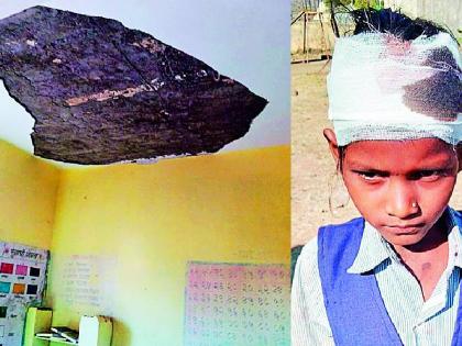 girl student injured in a accident after piece of the slab of school classroom collapsed | शाळेच्या वर्गखोलीचा तुकडा कोसळला, विद्यार्थिनी जखमी