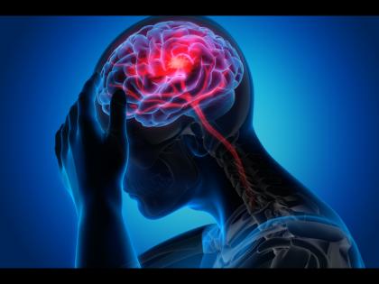 Stroke Sign : According to study before 1 week 43 of stroke patients report the same symptoms | स्ट्रोकच्या 7 दिवसांआधी दिसतात ही 8 लक्षणे, वेळीच व्हा सावध!