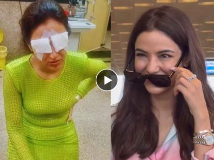 Jasmin Bhasin seen for the first time after an eye injury spotted at Mumbai airport | डोळ्यांच्या दुखापतीनंतर पहिल्यांदाच दिसली जॅस्मीन भसीन, गॉगल काढून दाखवली स्थिती; Video व्हायरल