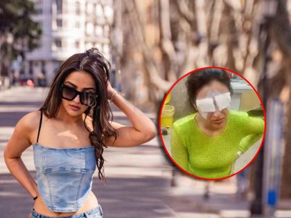 jasmine bhasin suffered with eye injury cornia gets dammaged after using lens | लेन्स लावल्याने डोळ्यांना त्रास झाला, आता दिसणंही झालं बंद; प्रसिद्ध अभिनेत्रीबरोबर नेमकं काय घडलं?