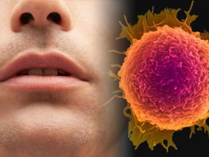 Nagpur has overtaken Pune and Aurangabad in oral cancer | मुखाच्या कर्करोगात नागपूरने पुणे, औरंगाबादला टाकले मागे