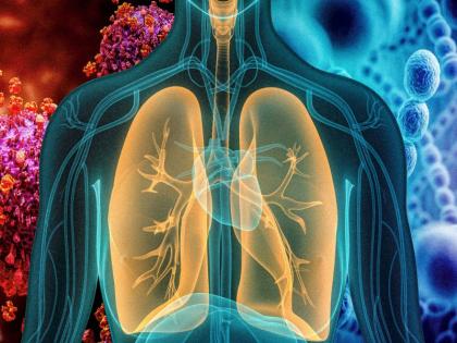 Pneumonia outbreak is increasing along with Corona in Mumbai along with the state. | मुंबईकरांच्या भेटीला आता न्यूमाेनिया आलाय; कोरोना, इन्फ्युएंजाच्या पार्श्वभूमीवर रुग्णांमध्ये वाढ