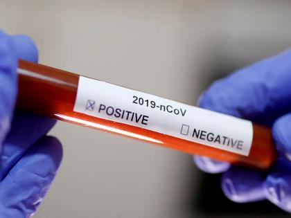 CoronaVirus 53 journalists test positive for covid 19 in Mumbai | CoronaVirus: मुंबईत ५३ पत्रकारांना कोरोनाची लागण; महापौर होम क्वारंटाइन