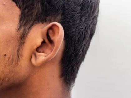 Girls in hostel were teased daughter in law bit her got five stitches on her ear, and was also stabbed in the stomach | Pune: हॉस्टेलमधील मुलींची छेड काढली; सुनेने घेतला चावा, कानावर पाच टाके, पोटावरही वार केले Girls in hostel were teased daughter in law bit her got five stitches on her ear, and was also stabbed in the stomach | Pune: हॉस्टेलमधील मुलींची छेड काढली; सुनेने घेतला चावा, कानावर पाच टाके, पोटावरही वार केले