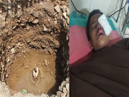 School student seriously injured after falling into a pit in Kolhapur, the pit was removed to clear the leaking water pipe | Kolhapur: खड्ड्यात पडून शाळकरी विद्यार्थी गंभीर जखमी, जलवाहिनीची गळती काढण्यासाठी काढला होता खड्डा