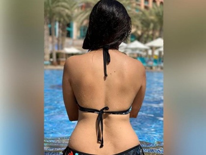 Kamya Panjabi Shared bikini photos, the actress showed body abscesses, saying - stories behind each | बिकनीतील फोटो शेअर करत या अभिनेत्रीनं दाखवले शरीरावरील व्रण, म्हणाली- प्रत्येक व्रणामागे कहाणी