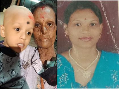 When will I be independent? Surviving Kavita of acid attack survivor | मी स्वतंत्र कधी होणार? ॲसिड हल्ल्यातून बचावलेल्या कविताचा जगण्याचा संघर्ष