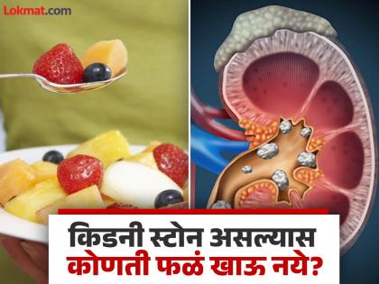 Which fruits to avoid during stone and what fruits are good in stones | किडनी स्टोन असल्यावर कोणती फळं खावीत आणि कोणती टाळावीत?