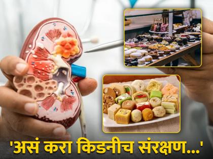 health tips for avoid sweet food to protect kidney from damage to eat more sweet  will increasing problem of stone  | तुम्ही सुद्धा गोड खाण्याचे शौकीन आहात? आजच बदला 'या' सवयी, नाहीतर होतील गंभीर परिणाम