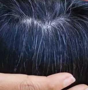 आठवी-नववीतच मुलामुलींचे केस पांढरे होतात-गळतातही फार? डॉक्टर सांगतात ४ चुका-पालकांसाठी खास सल्ला