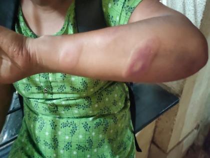 Student beaten up for failing maths; Incident in Ghansoli | गणित चुकल्याने विद्यार्थिनीला मारहाण; घणसोलीतली घटना