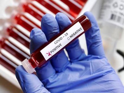 CoronaVirus News 14 minor girls from Kolhapur Child Welfare Complex tested corona positive | CoronaVirus News: धक्कादायक! कोल्हापूरच्या बालकल्याण संकुलातील १८ वर्षांखालील १४ मुली कोरोना पॉझिटिव्ह CoronaVirus News 14 minor girls from Kolhapur Child Welfare Complex tested corona positive | CoronaVirus News: धक्कादायक! कोल्हापूरच्या बालकल्याण संकुलातील १८ वर्षांखालील १४ मुली कोरोना पॉझिटिव्ह