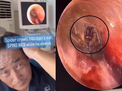 Spider In Ear; doctor was shocked to see, watch the shocking video | कानात कोळ्याने केले घर; पाहून डॉक्टरही चक्रावून गेले, पाहा अंगावर काटा आणणारा व्हिडिओ...