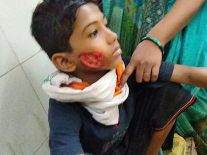 Four including three children were attacked by a mauled dog | पिसाळलेल्या कुत्र्याचा तीन बालकांसह चौघांवर हल्ला