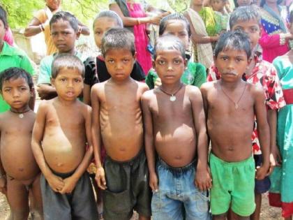 328 acutely malnourished children in Sangli district | सधन सांगली जिल्ह्यात चक्क 'इतकी' कुपोषित बालके, अडीच हजारांवर मुलांचे वजन कमी 