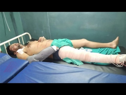 Nepal international Lalit Bhandari hospitalised after bike accident | भीषण अपघातात क्रिकेटपटू गंभीर जखमी; दोन्ही हात व पायांवर करावी लागेल शस्त्रक्रिया?