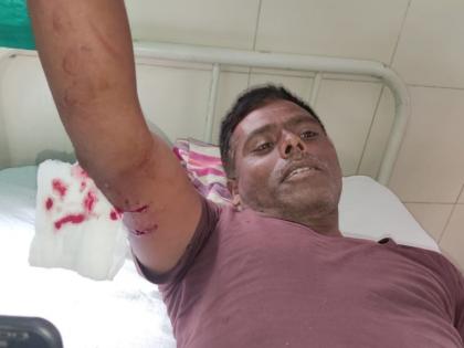 Farmers injured in leopard attack | बिबट्याच्या हल्ल्यात शेतकरी जखमी 