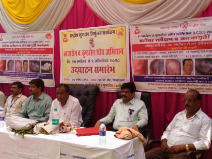 The introduction of vitiligo, leprosy detection campaign | त्वचारोग, कुष्ठरोग शोध अभियानाला प्रारंभ