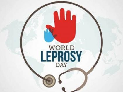 Leprosy, tuberculosis campaign will be implemented in the city | शहरात कुष्ठरोग, क्षयरोग शोधमोहीम राबविणार