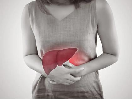 Jaundice is a 'silent killer' that slowly spreads through the body; what are the symptoms? | कावीळ म्हणजे शरीरात हळूहळू पसरणारा ‘सायलेंट किलर’च; काय आहेत लक्षणे?