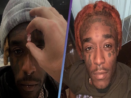 rapper lil uzi vert implants pink diamond worth usd 24 million on forehead mocked publicly | OMG! रॅपरनं अब्जावधी खर्चून कपाळावर कोरला ‘तिसरा डोळा’, आता वेदनेनं झाला बेहाल