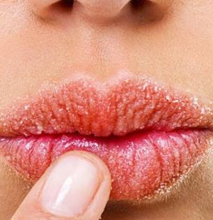 थंडीत ओठ फुटतात, रक्त येतं, भेगाही पडतात? ५ उपाय-हिवाळ्यातही ओठ राहतील मऊमुलायम गुलाबी