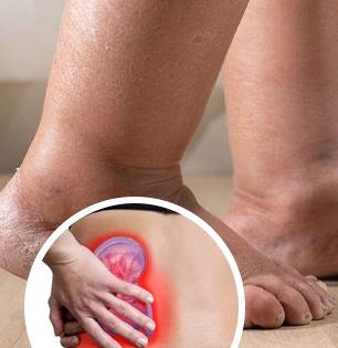 पायांवर सतत सूज-खाजही सुटते? हे तर लिव्हरच्या गंभीर आजाराचे लक्षण, जीवाला धोका आहे..