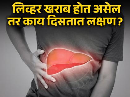 The symptoms that appear on the hands and feet when the liver is damaged | लिव्हर खराब होत असल्यावर हात आणि पायांवर दिसतात 'ही' लक्षण, वेळीच व्हा सावध!