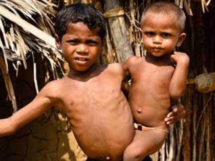 FDA should inspect the distribution of nutritional food in malnutrition-affected districts | कुपोषणग्रस्त जिल्ह्यातील पोषण आहार वाटपाची एफडीएमार्फत तपासणी व्हावी FDA should inspect the distribution of nutritional food in malnutrition-affected districts | कुपोषणग्रस्त जिल्ह्यातील पोषण आहार वाटपाची एफडीएमार्फत तपासणी व्हावी