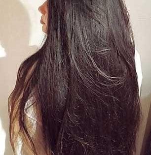 कोंड्यामुळे डोक्याला सुटते खाज-चारचौघात वाटते लाज, पाहा जावेद हबीबचा उपाय-काही दिवसांत कोंडा गायब