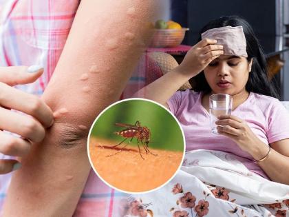 malaria fear in patients direct effect on brain kidneys about 1 thousand 612 patients in six months in mumbai  | रुग्णांमध्ये मलेरियाची दहशत,थेट मेंदू, किडनीवर होतो परिणाम; ६ महिन्यांत १ हजार ६१२ रुग्ण 