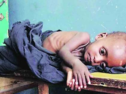 More than 1400 child deaths in Melghat in five years | मेळघाटात पाच वर्षांत चौदाशेहून अधिक बालमृत्यू