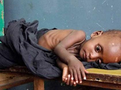 when end Melghat's childhood fatality, malnutrition? | मेळघाटाच्या ललाटीचा बालमृत्यू, कुपोषणाचा डाग केव्हा हटेल?